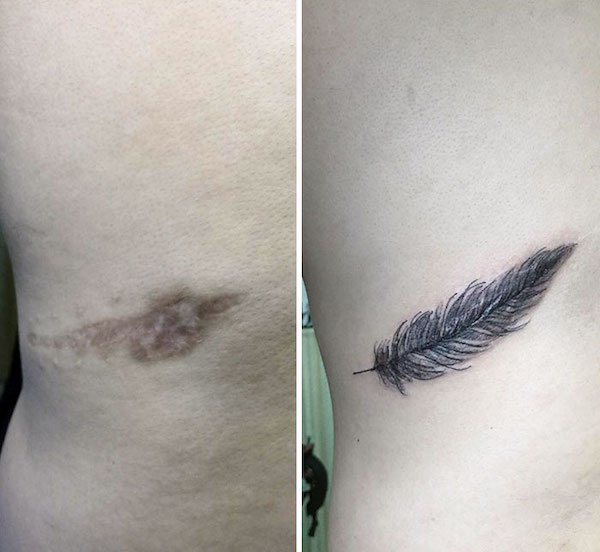 Tattoo artists nailed the brief to cover up scars and birthmarks